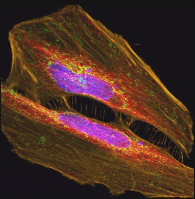 HeLa cells mounted with Prolong Glass and imaged with confocal microscope
